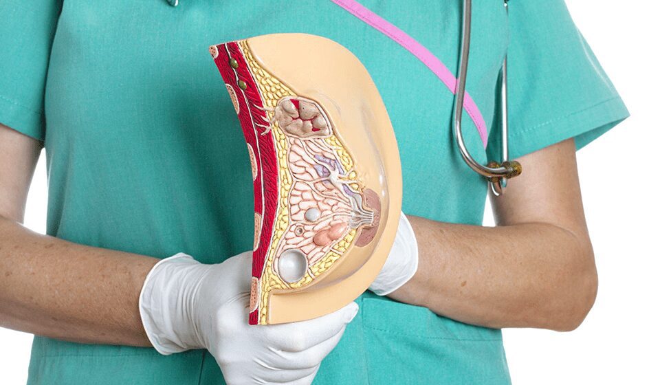 Decide Whether I am a Candidate for Breast Surgery