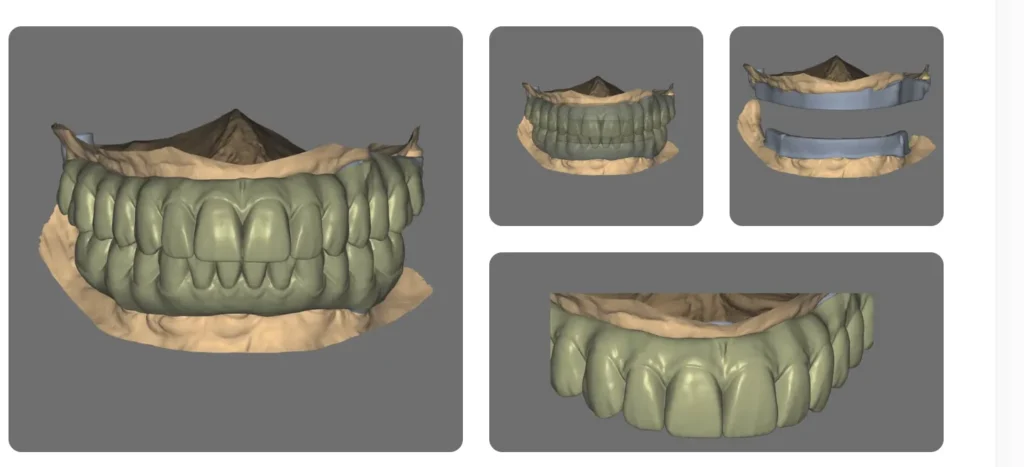 Service Capabilities and Software